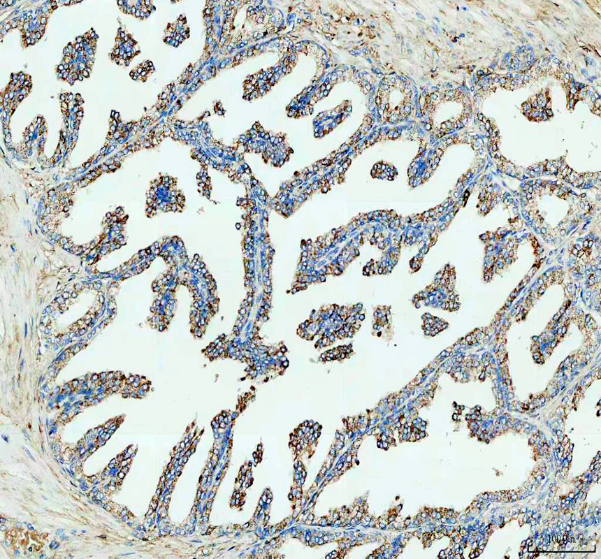 IHC analysis of ARG2 using anti-ARG2 antibody (A02244)