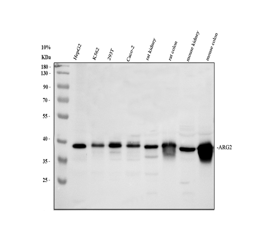 Western blot analysis of ARG2 using anti-ARG2 antibody (A02244)