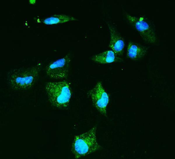 a02245 slc2a9 primary antibodies icc testing 6