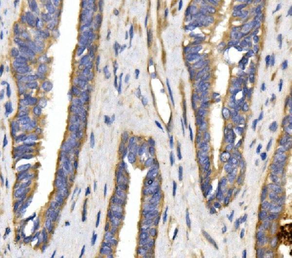 a02245 slc2a9 primary antibodies ihc testing 2