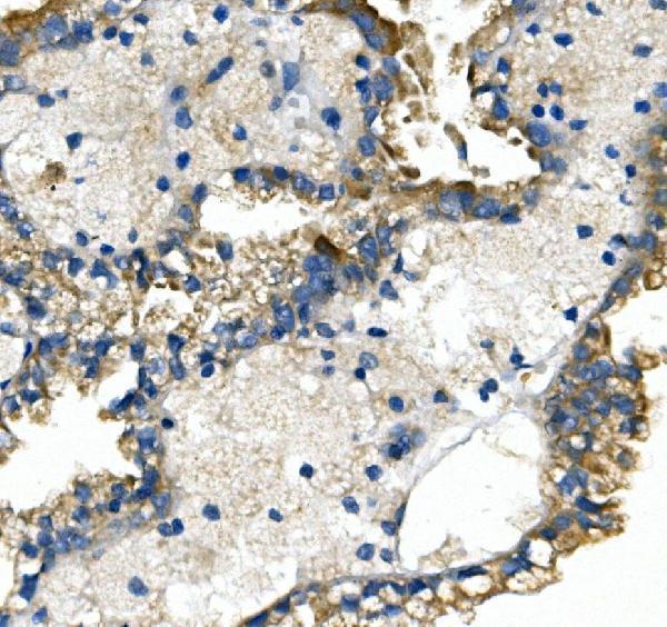 a02245 slc2a9 primary antibodies ihc testing 3
