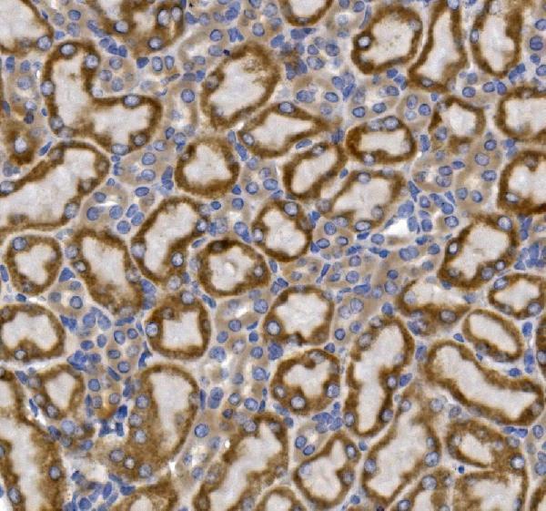 a02245 slc2a9 primary antibodies ihc testing 4