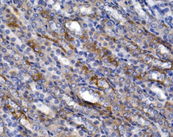 a02245 slc2a9 primary antibodies ihc testing 5