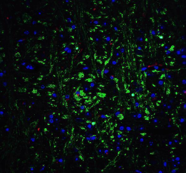 a02247 1 olig2 primary antibodies if testing 5