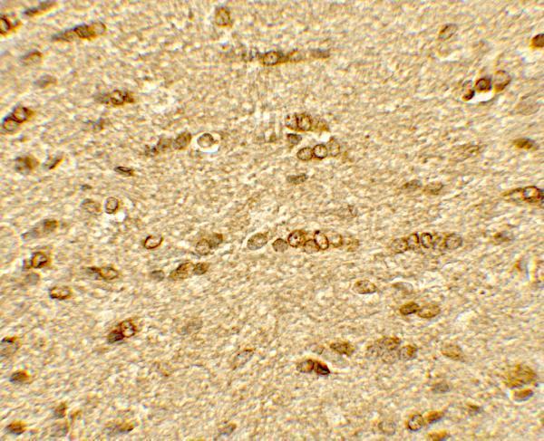 a02247 1 olig2 primary antibodies ihc testing 2