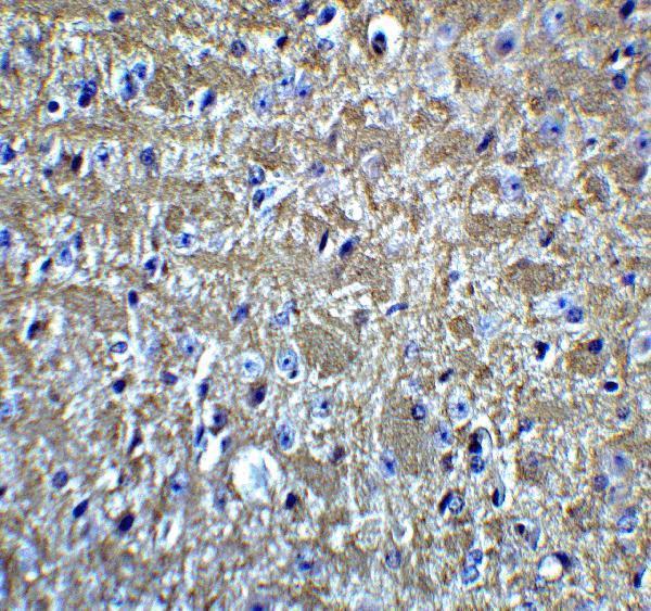 a02247 1 olig2 primary antibodies ihc testing 4