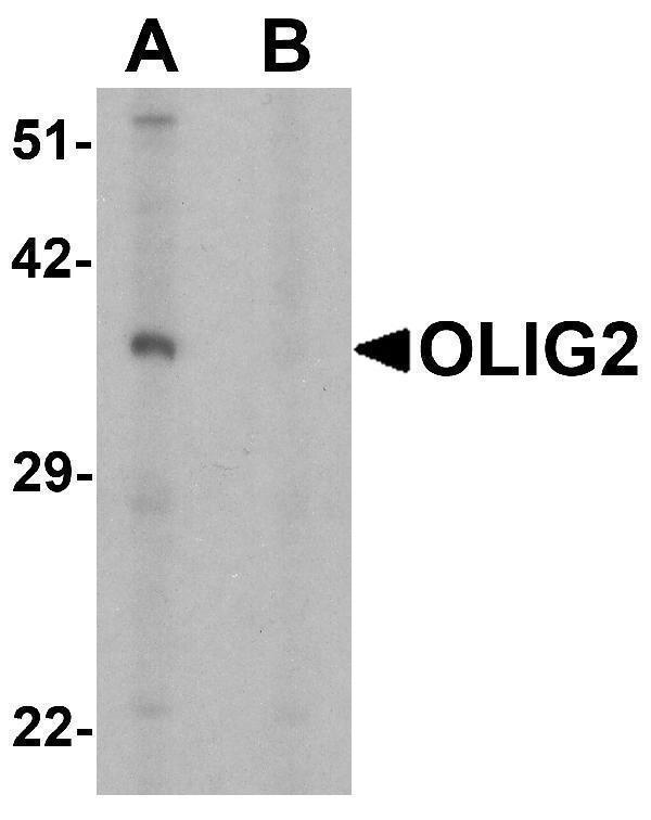 a02247 1 olig2 primary antibodies wb testing 1