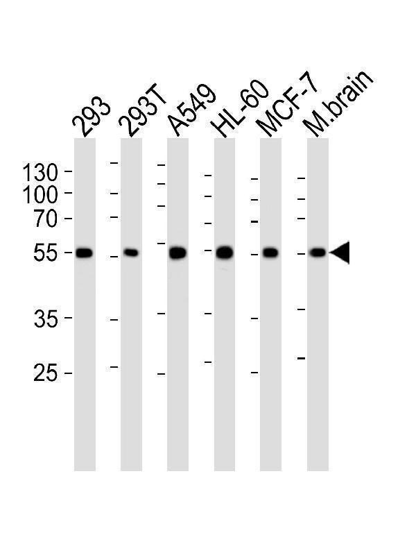 Western blot analysis of lysates from 293, 293T, A549, HL-60, MCF-7 cell line and mouse brain tissue lysate (from left to right), using DKK3 Antibody (A30)