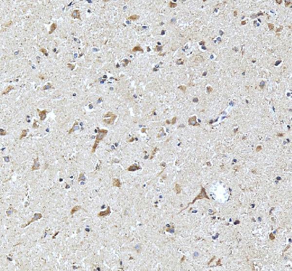 IHC analysis of DKK3 using anti-DKK3 antibody (A02248-2)