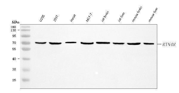  Western blot analysis of Nogo Receptor/NgR1/RTN4R using anti-Nogo Receptor/NgR1/RTN4R antibody (A02250-2)
