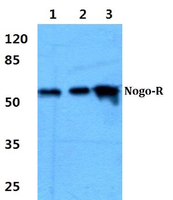 Western blot (WB) analysis of Nogo-R polyclonal antibody at 1:500 dilution
Lane1:A549 cell lysate
Lane2:Mouse brain tissue lysate
Lane3:Rat brain tissue lysate
