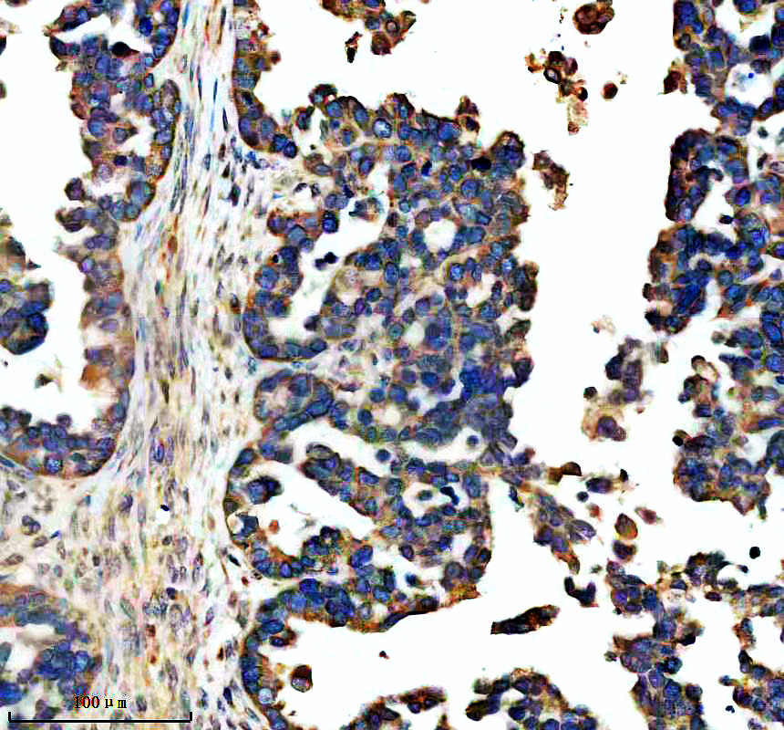 a02251 1 npr2 primary antibodies ihc testing 1