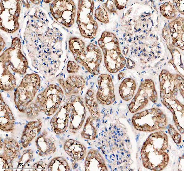 IHC analysis of FOLR1 using anti-FOLR1 antibody (A02254-3)