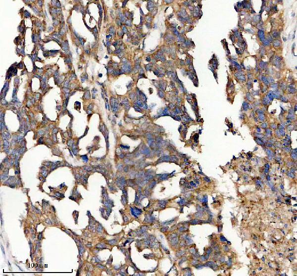 IHC analysis of FOLR1 using anti-FOLR1 antibody (A02254-3)