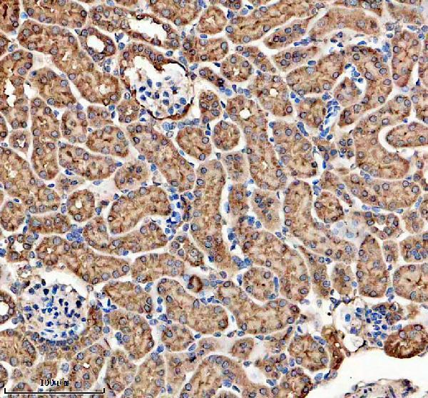 a02254 3 folr1 primary antibodies ihc testing 3