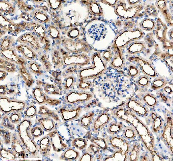 a02254 3 folr1 primary antibodies ihc testing 4