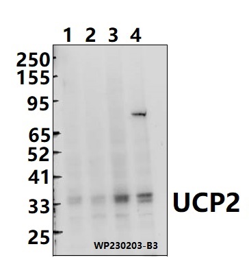 a02256 ucp2 primary antiboties wb testing 1