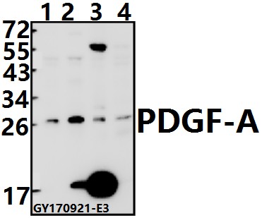 Western blot (WB) analysis of PDGF-A (K154) pAb at 1:500 dilution
Lane1:MCF-7 whole cell lysate(40ug)
Lane2:Hela whole cell lysate(40ug)
Lane3:The Lung tissue lysate of Mouse(40ug)
Lane4:PMVEC whole cell lysate(40ug)