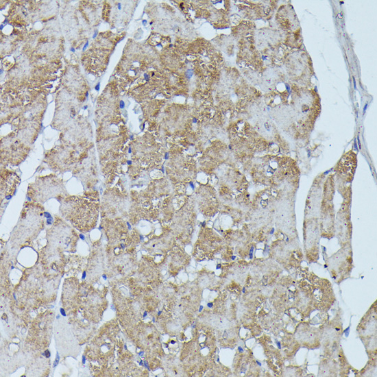 Immunohistochemistry of paraffin-embedded rat heart using FLII antibody  at dilution of 1:100 