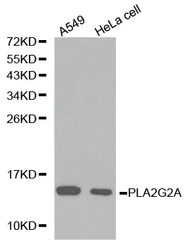 a02259 pla2g2a primary antiboties wb testing 1