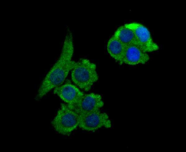 ICC staining NCK1 in LOVO cells (green)