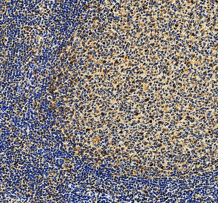 a02260 2 nck1 primary antibodies ihc testing 1