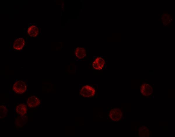 Immunofluorescence of IL-28B in HeLa cells with IL-28B antibody at 5 μg/mL
