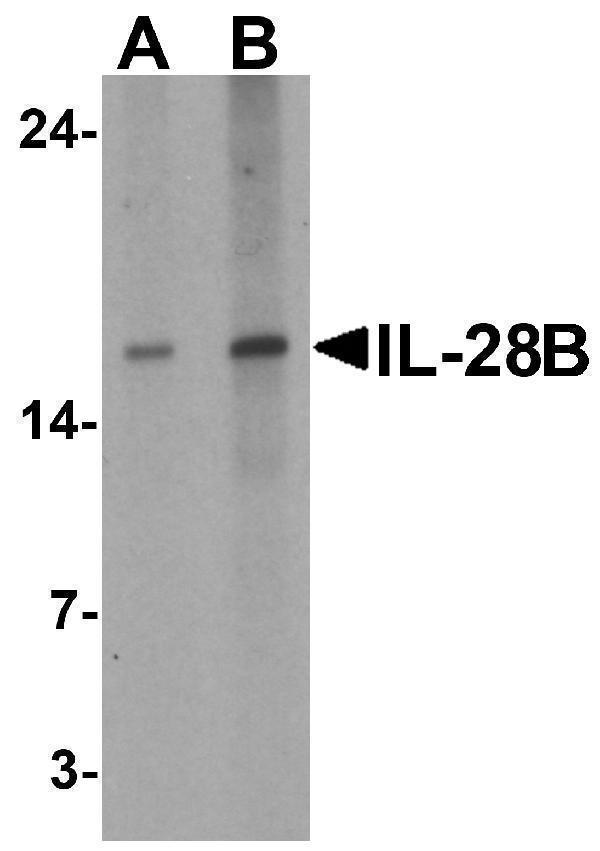Western blot analysis of IL-28B in HeLa cell lysate with IL-28B antibody at (A) 1 and (B) 2 μg/ml