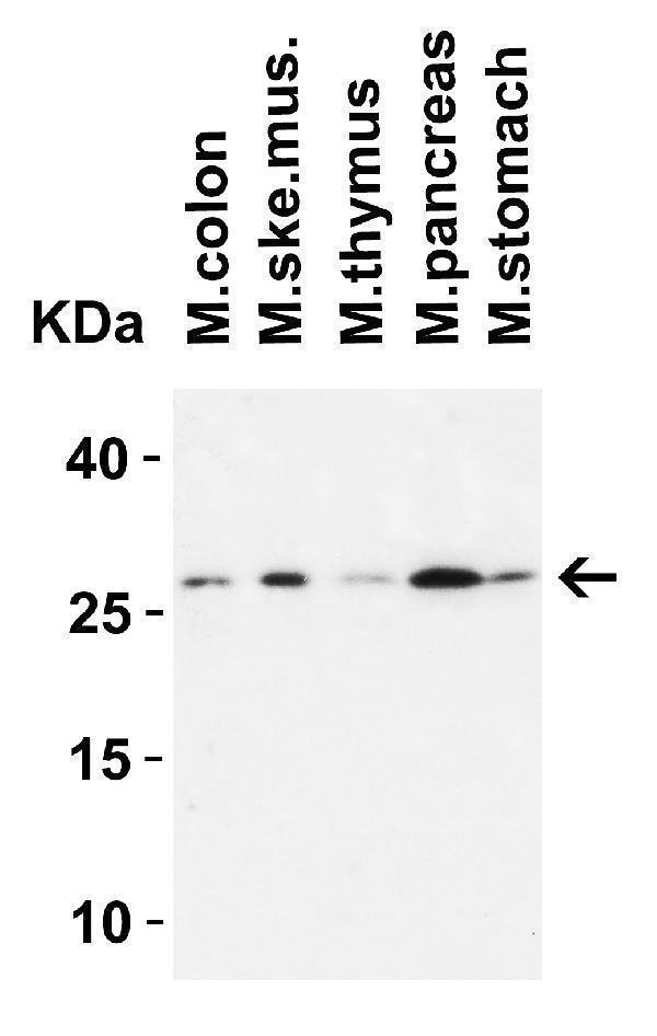  WB Validation in Mouse Tissues
Loading: 15 μg of lysate