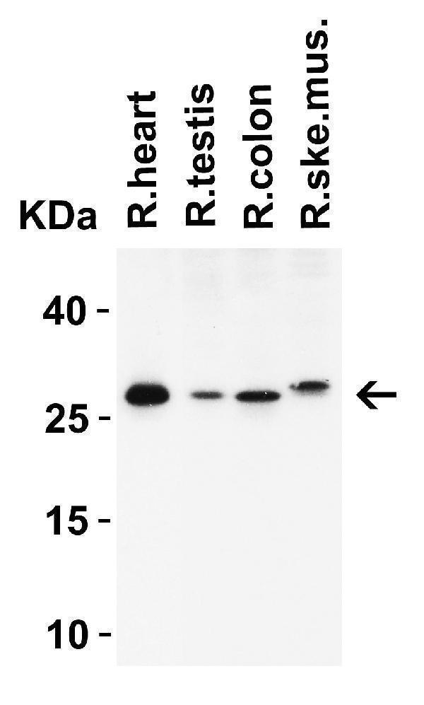 Western Blot Validation in Rat Tissues  
Loading: 15 μg of lysates per lane