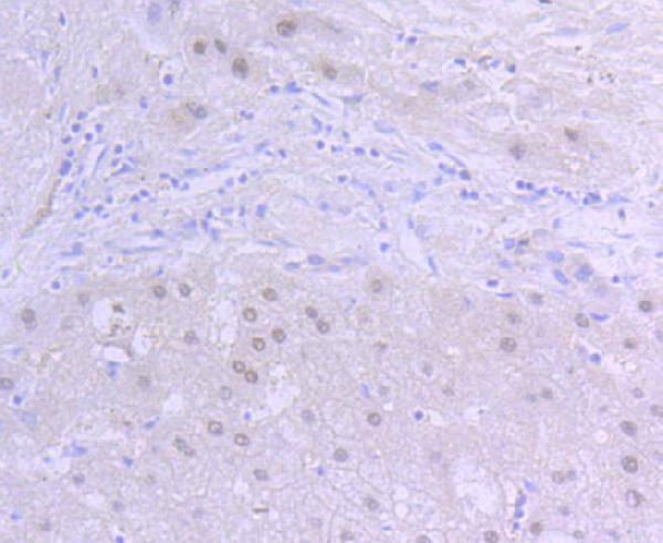 a02263 arnt primary antiboties ihc testing 2