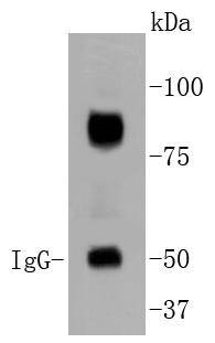 a02263 arnt primary antiboties wb testing 1