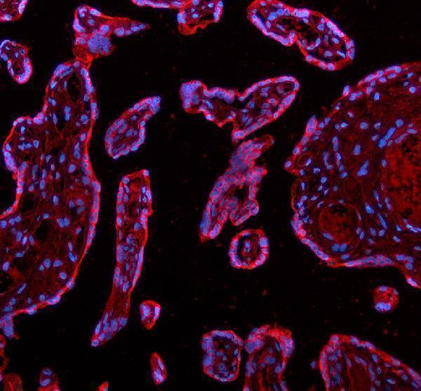 a02264 2 adam12 primary antibodies if testing 2