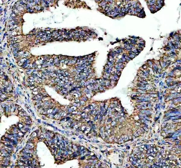 a02264 2 adam12 primary antibodies ihc testing 1
