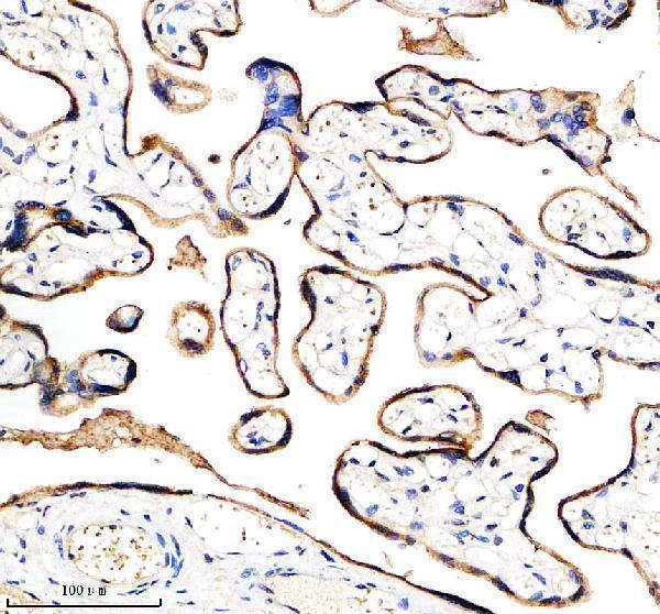  IHC analysis of ADAM12 using anti-ADAM12 antibody (A02264-2)