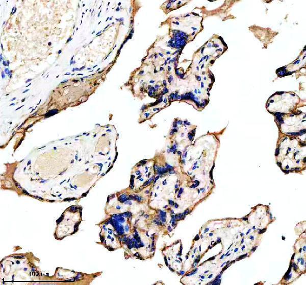 a02264 2 adam12 primary antibodies ihc testing 2_1