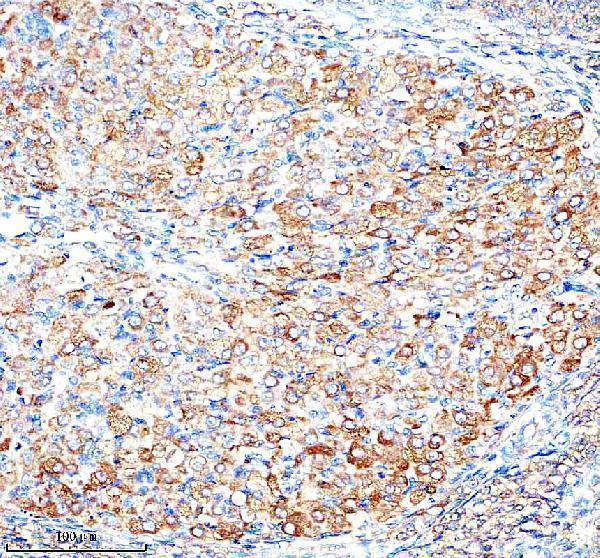  IHC analysis of ADAM12 using anti-ADAM12 antibody (A02264-2)