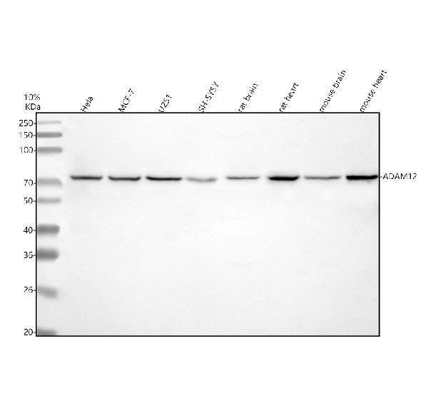  Western blot analysis of ADAM12 using anti-ADAM12 antibody (A02264-2)