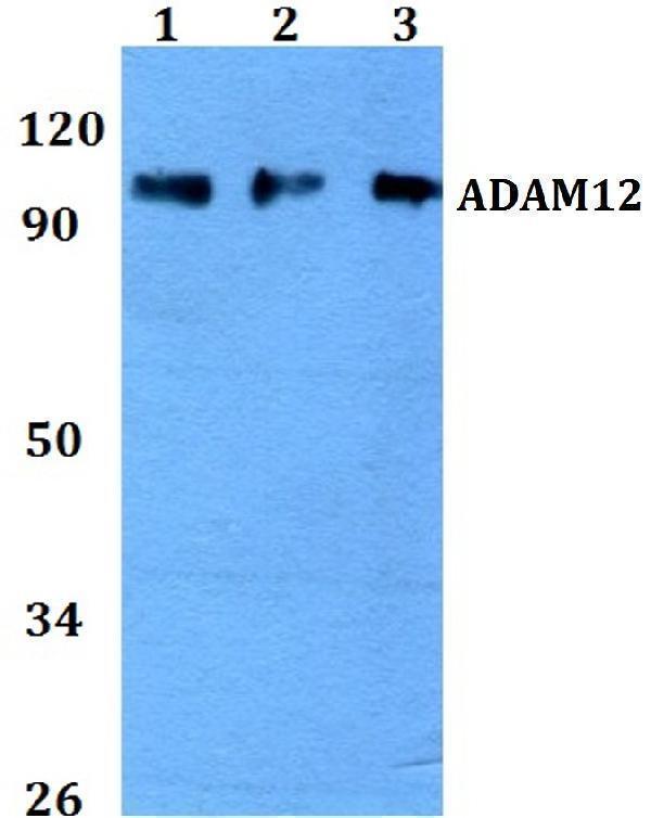 Western blot (WB) analysis of ADAM12 polyclonal antibody at 1:500 dilution
Lane1:HEK293T whole cell lysate
Lane2:Raw264