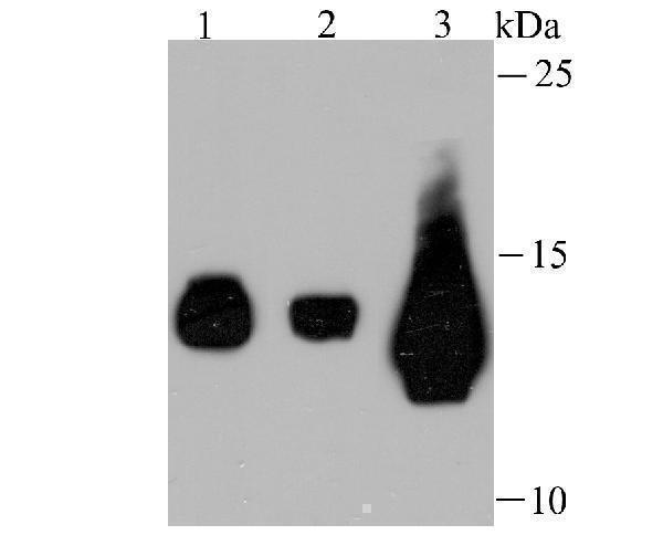 Western blot analysis of Fragilis on different cell lysates using anti-Fragilis antibody at 1/500 dilution