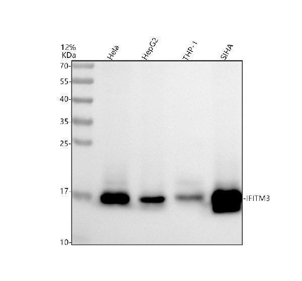 Western blot analysis of IFITM3 using anti-IFITM3 antibody (A02265-2)