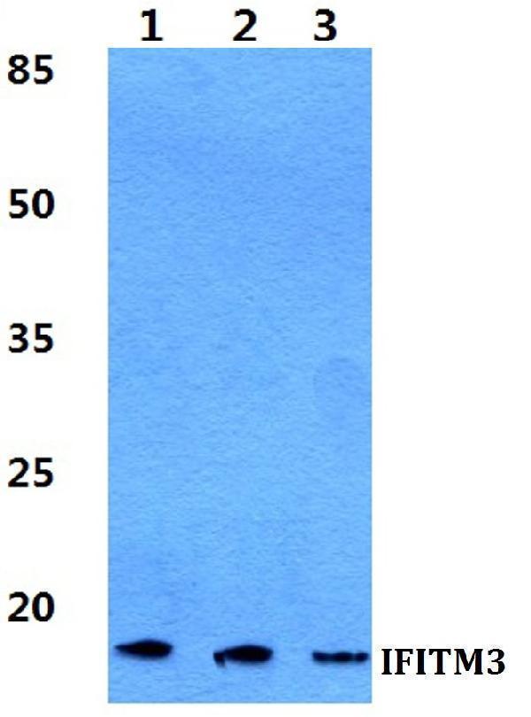 Western blot (WB) analysis of IFITM3 polyclonal antibody at 1:500 dilution
Lane1:HEK293T cell lysate
Lane2:Raw264