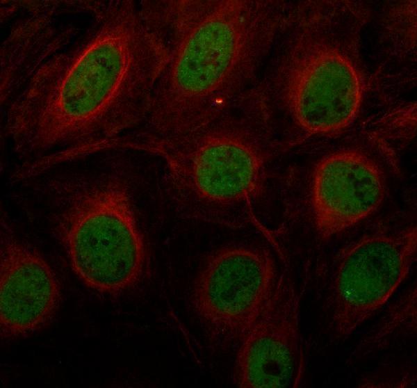 a02266 2 rora primary antibodies if testing 1