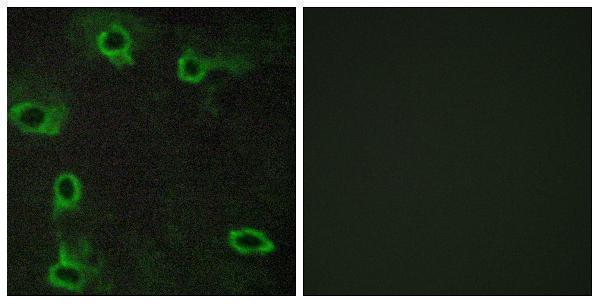 a02268 1 adora2a primary antibodies if testing 1