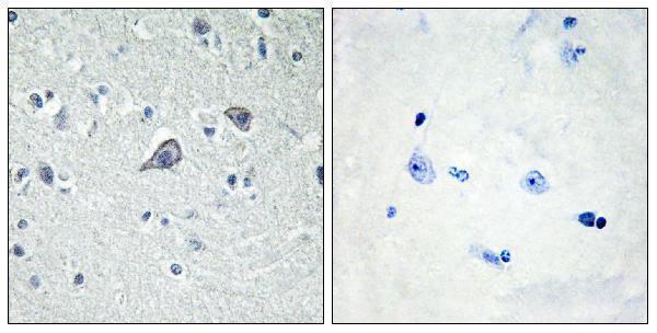 a02268 1 adora2a primary antibodies ihc testing 4