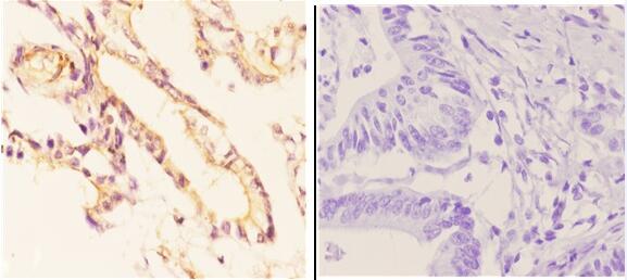 a02268y361 adora2a primary antiboties ihc testing 2