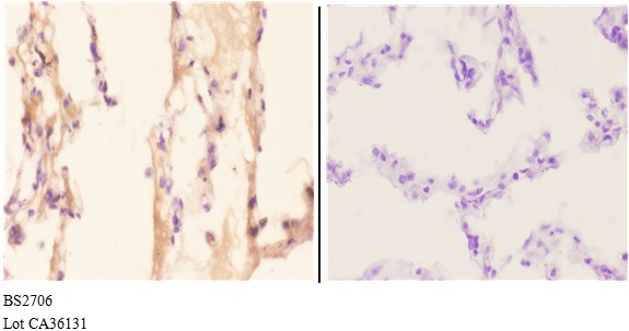 a02268y361 adora2a primary antiboties ihc testing 3