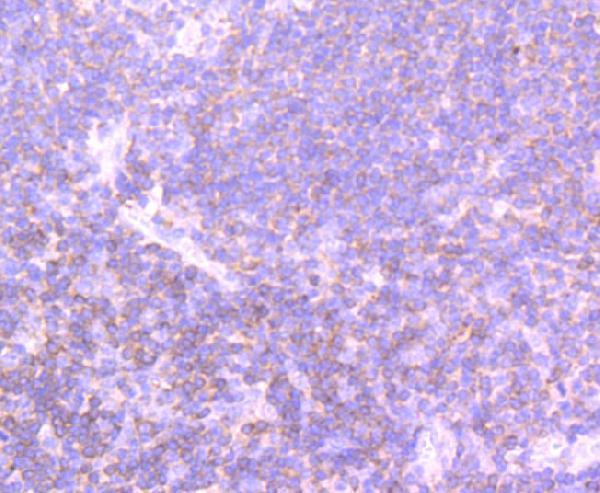 Immunohistochemical analysis of paraffin-embedded human tonsil tissue using anti-PI 3 Kinase p110 delta antibody