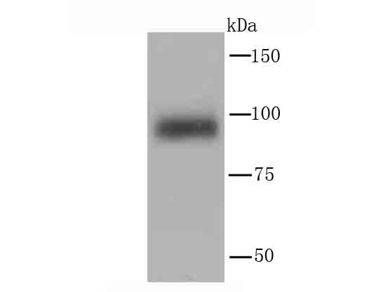Western blot analysis of PI 3 Kinase p110 delta on mouse spleen tissue lysate using anti-PI 3 Kinase p110 delta antibody at 1/1,000 dilution
