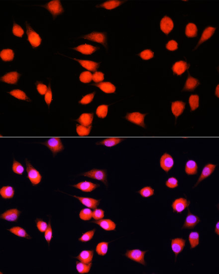 Immunofluorescence analysis of L929 cells using COMMD1 antibody  at dilution of 1:100